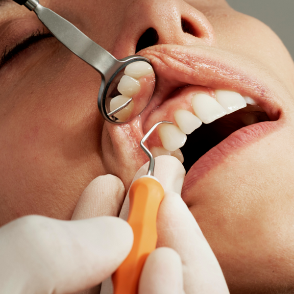 The Ultimate Guide to Preventing Dental Plaque and Tartar - Expert Tips for a Healthy Smile