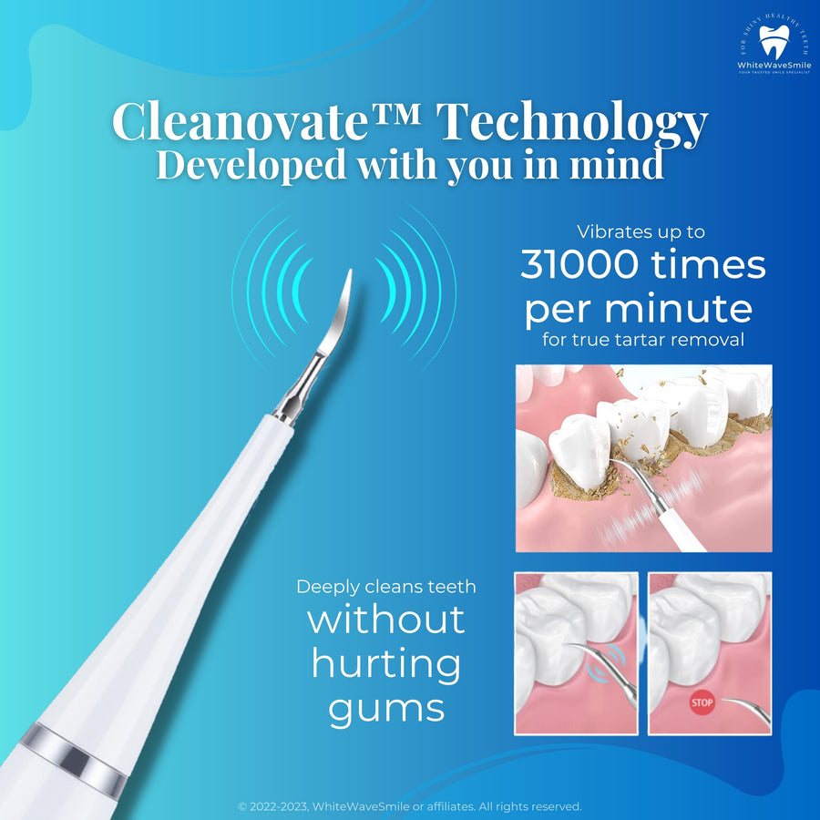 Best home electric dental scaler vibrates fastest for best tartar removal. Safe and effective. Remove tartar at home easily with Oral Refresh from WhiteWaveSmile.