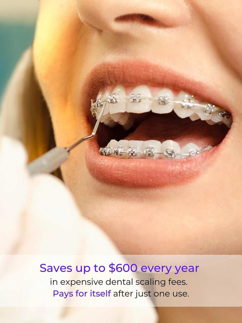 customers save money with WhiteWaveSmile world's best home dental products